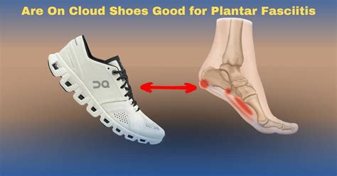 cloud shoes for plantar fasciitis.